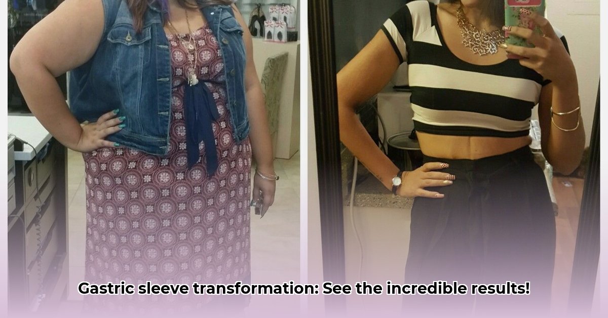 before-after-pictures-weight-loss-surgery